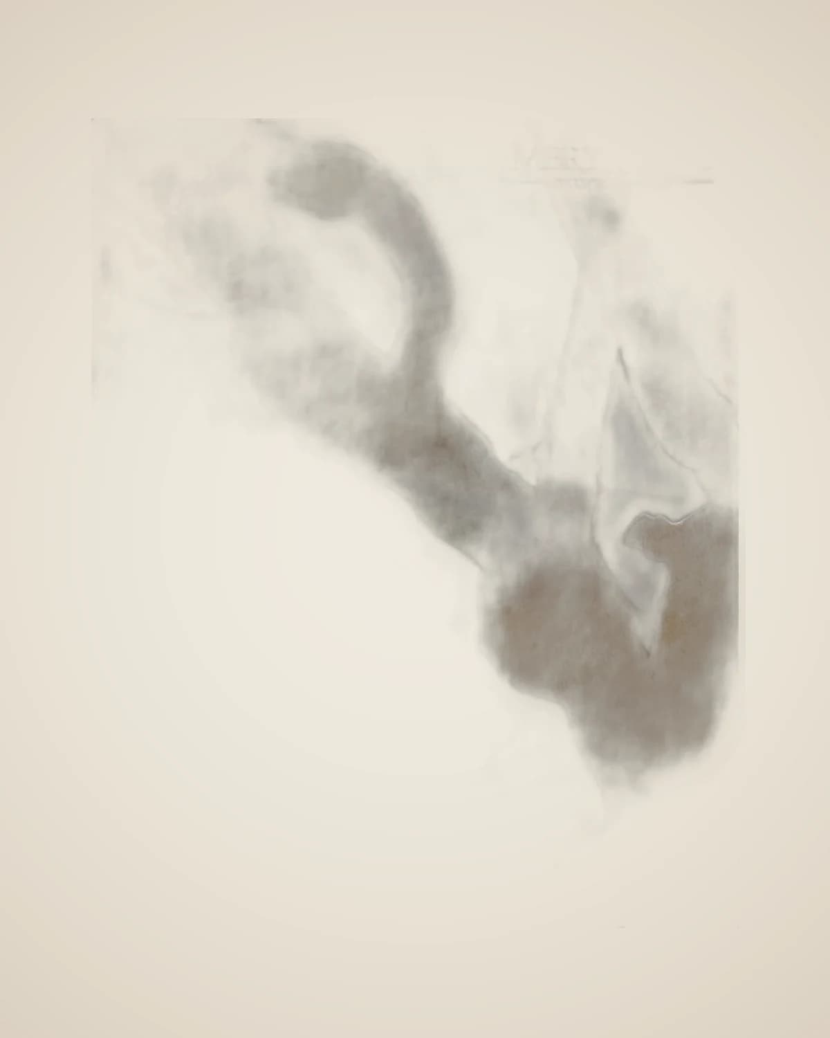 Chi dekoratives Goldgemälde mit Baummotiv, 87 x 87 cm — TUTA — 5